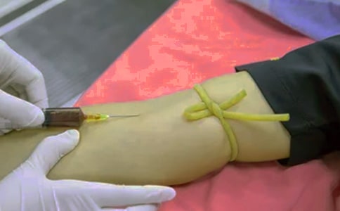 艾滋病患者作文